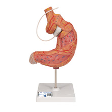 Load image into Gallery viewer, Model de stomac uman cu bandă gastrică, 2 părţi - 3B Smart Anatomy