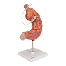 Load image into Gallery viewer, Model de stomac uman cu bandă gastrică, 2 părţi - 3B Smart Anatomy