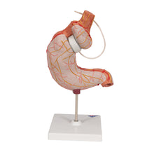 Load image into Gallery viewer, Model de stomac uman cu bandă gastrică, 2 părţi - 3B Smart Anatomy