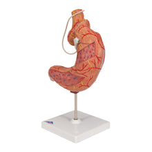 Load image into Gallery viewer, Model de stomac uman cu bandă gastrică, 2 părţi - 3B Smart Anatomy