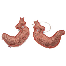 Load image into Gallery viewer, Model de stomac uman cu bandă gastrică, 2 părţi - 3B Smart Anatomy