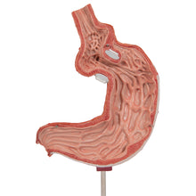 Load image into Gallery viewer, Model de stomac uman cu bandă gastrică, 2 părţi - 3B Smart Anatomy