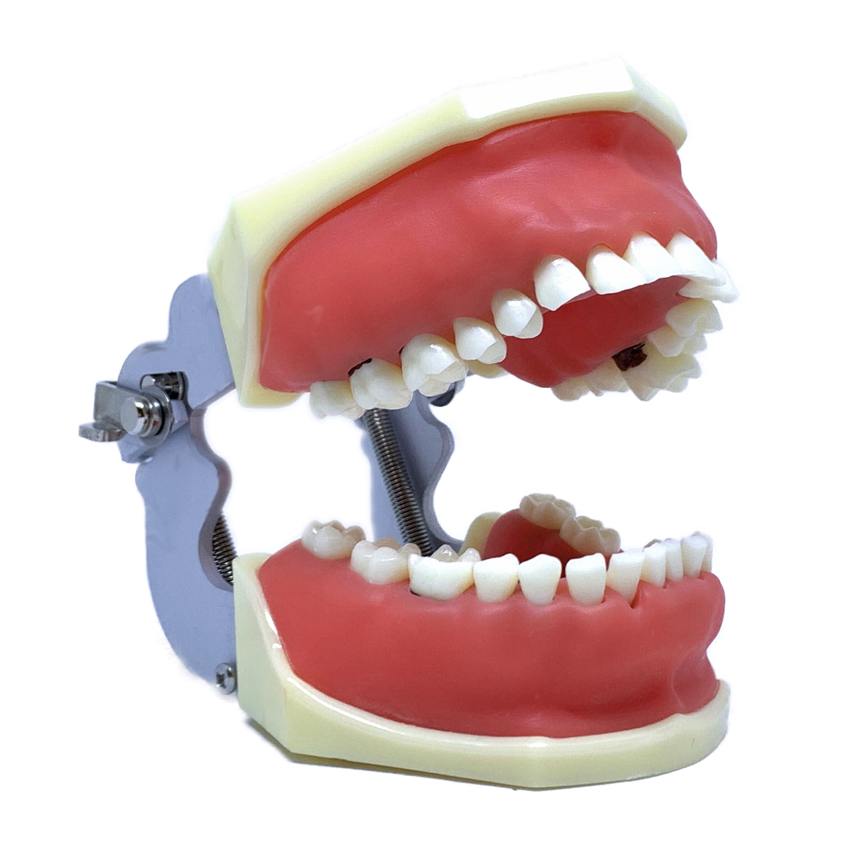 Model Boală Parodontală Cu Dinţi Detaşabili Cu şurub 4027 Anatomika 