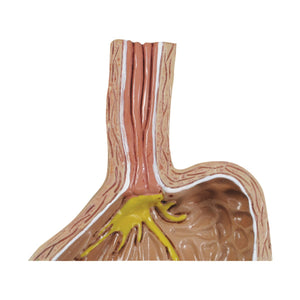 4 bucăţi Gerd - (Boala de reflux gastro-esofagian)