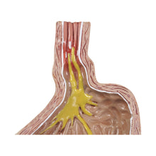 Load image into Gallery viewer, 4 bucăţi Gerd - (Boala de reflux gastro-esofagian)