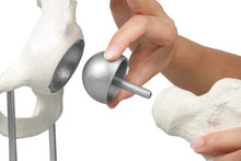 Load image into Gallery viewer, Model - Articulaţia şoldului cu implant resurfacing