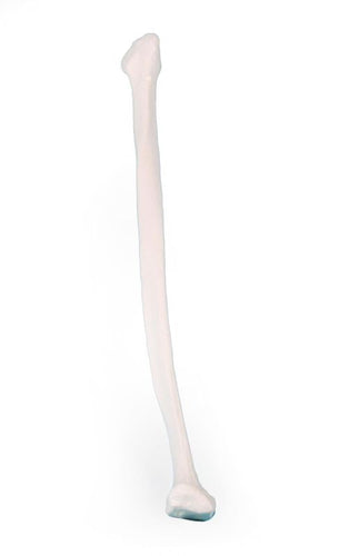 Model peroneu