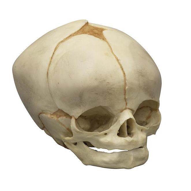 Craniu fetal 40 ½ săptămâni