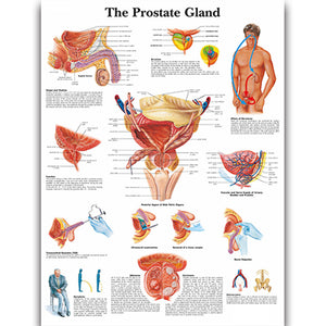 Poster "Prostata"