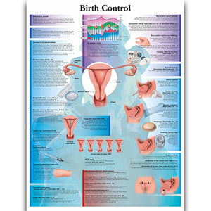Poster "Contracepţie"