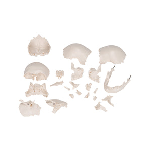 Model craniu adult Beauchene, versiune color, 22 de componente - 3B Smart Anatomy