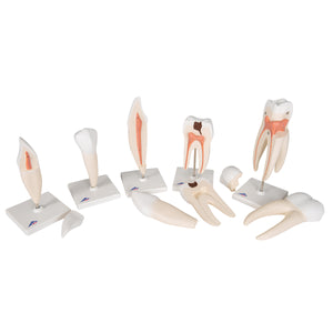 Set de modele dinţi umani „Seria Clasică”, 5 Modele - 3B Smart Anatomy