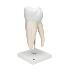 Load image into Gallery viewer, Model de dinte uman molar gigant cu cavităţi dentare, de 15 ori mărimea naturală, în 6 părţi - 3B Smart Anatomy
