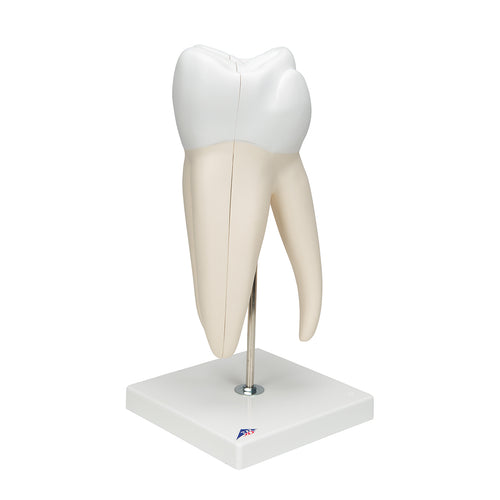 Model de dinte uman molar gigant cu cavităţi dentare, de 15 ori mărimea naturală, în 6 părţi - 3B Smart Anatomy