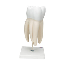 Load image into Gallery viewer, Model de dinte uman molar gigant cu cavităţi dentare, de 15 ori mărimea naturală, în 6 părţi - 3B Smart Anatomy
