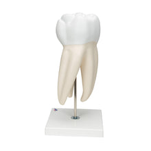 Load image into Gallery viewer, Model de dinte uman molar gigant cu cavităţi dentare, de 15 ori mărimea naturală, în 6 părţi - 3B Smart Anatomy