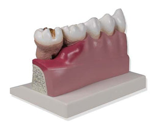 Model dentar, de 4 ori dimensiunea naturală - EZ Augmented Anatomy