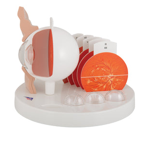 Model patologic de ochi uman - 3B Smart Anatomy