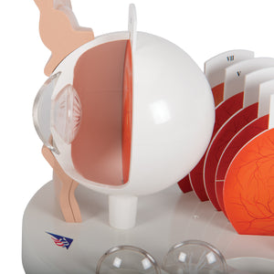 Model patologic de ochi uman - 3B Smart Anatomy