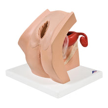 Load image into Gallery viewer, Model ginecologic pentru educaţia pacientului 3B Smart Anatomy