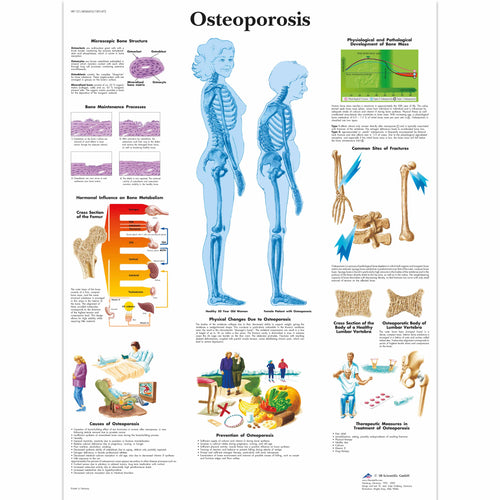 Poster Osteoporoza