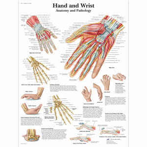 Poster 3B Scientific "Diagrama mâinii şi încheieturii mâinii - Anatomie și Patologie"