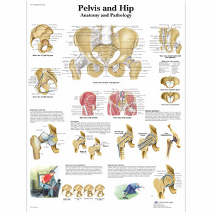 Poster 3B Scientific "Diagrama pelvisului şi șoldului - anatomie şi patologie"