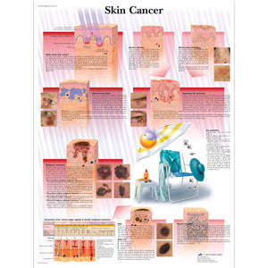 Poster "Cancer de piele" - 3B Scientific