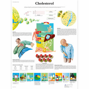 Poster "Colesterol" - 3B Scientific
