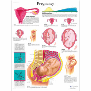 Poster ”Sarcina” 3B Scientific