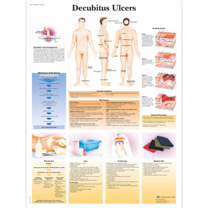 Poster "Ulcere de Decubit" - 3B Scientific