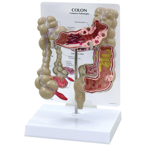 Model colon