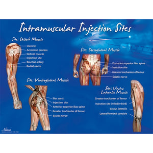 Poster: Locurile de injectare intramusculară