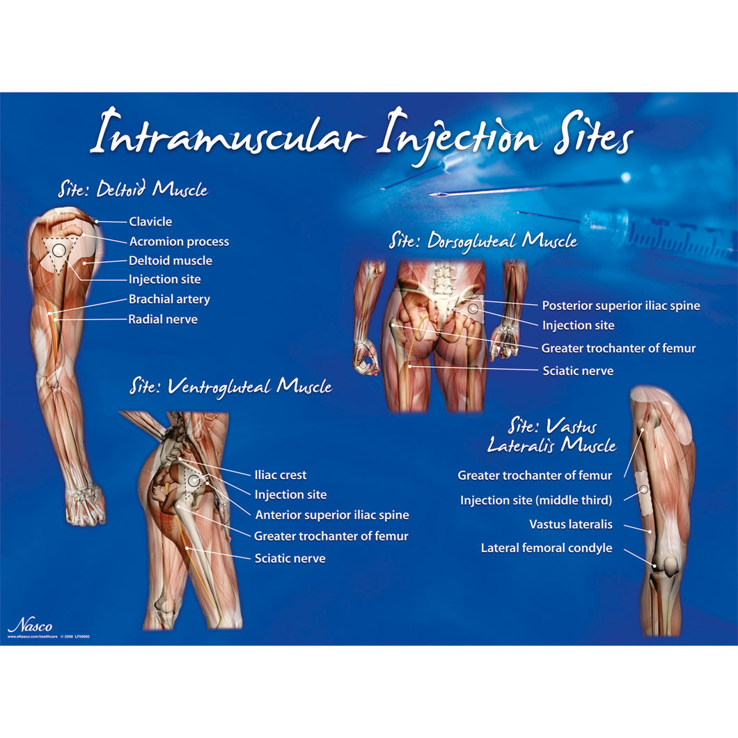 Poster: Locurile de injectare intramusculară