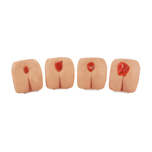 Modele de ulcer de presiune/escare de decubit (piele deschisă la culoare)