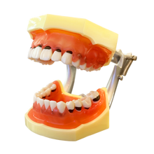 Load image into Gallery viewer, Rent-to-learn Model boală parodontală cu dinţi detaşabili cu şurub - 4023