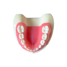 Load image into Gallery viewer, Rent-to-learn Model pedodonţie cu dinţi detaşabili cu şurub şi gingie fixă moale 7014