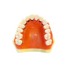 Load image into Gallery viewer, Rent-to-learn Model boală parodontală cu dinţi detaşabili cu şurub - 4023