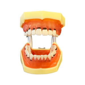 Rent-to-learn Model boală parodontală cu dinţi detaşabili cu şurub - 4023