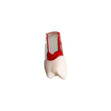 Load image into Gallery viewer, Endobloc 24 -  compatibil cu modelul cu dinţi detaşabili cu şurub 8011