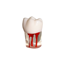 Load image into Gallery viewer, Endobloc 36 -  compatibil cu modelul cu dinţi detaşabili cu şurub 8011