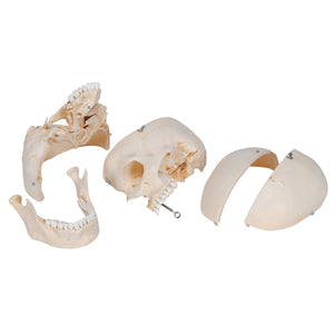 Model de craniu uman BONElike™, 6 componente - 3B Smart Anatomy