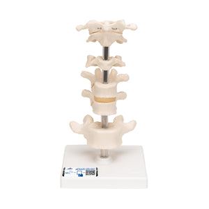 Model de 6 vertebre umane, montate pe suport (atlas, ax, cervical, 2x toracic, lombar) - 3B Smart Anatomy