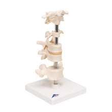 Load image into Gallery viewer, Model de 6 vertebre umane, montate pe suport (atlas, ax, cervical, 2x toracic, lombar) - 3B Smart Anatomy