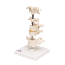 Load image into Gallery viewer, Model de 6 vertebre umane, montate pe suport (atlas, ax, cervical, 2x toracic, lombar) - 3B Smart Anatomy