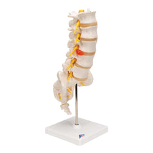 Load image into Gallery viewer, Model de coloană vertebrală lombară umană cu disc intervertebral prolapsat dorso-lateral - 3B Smart Anatomy