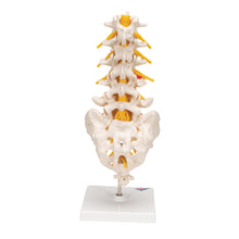 Load image into Gallery viewer, Model de coloană vertebrală lombară umană cu disc intervertebral prolapsat dorso-lateral - 3B Smart Anatomy