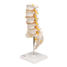 Load image into Gallery viewer, Model de coloană vertebrală lombară umană cu disc intervertebral prolapsat dorso-lateral - 3B Smart Anatomy