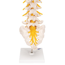 Load image into Gallery viewer, Model de coloană vertebrală lombară umană cu disc intervertebral prolapsat dorso-lateral - 3B Smart Anatomy