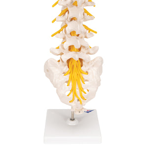 Model de coloană vertebrală lombară umană cu disc intervertebral prolapsat dorso-lateral - 3B Smart Anatomy